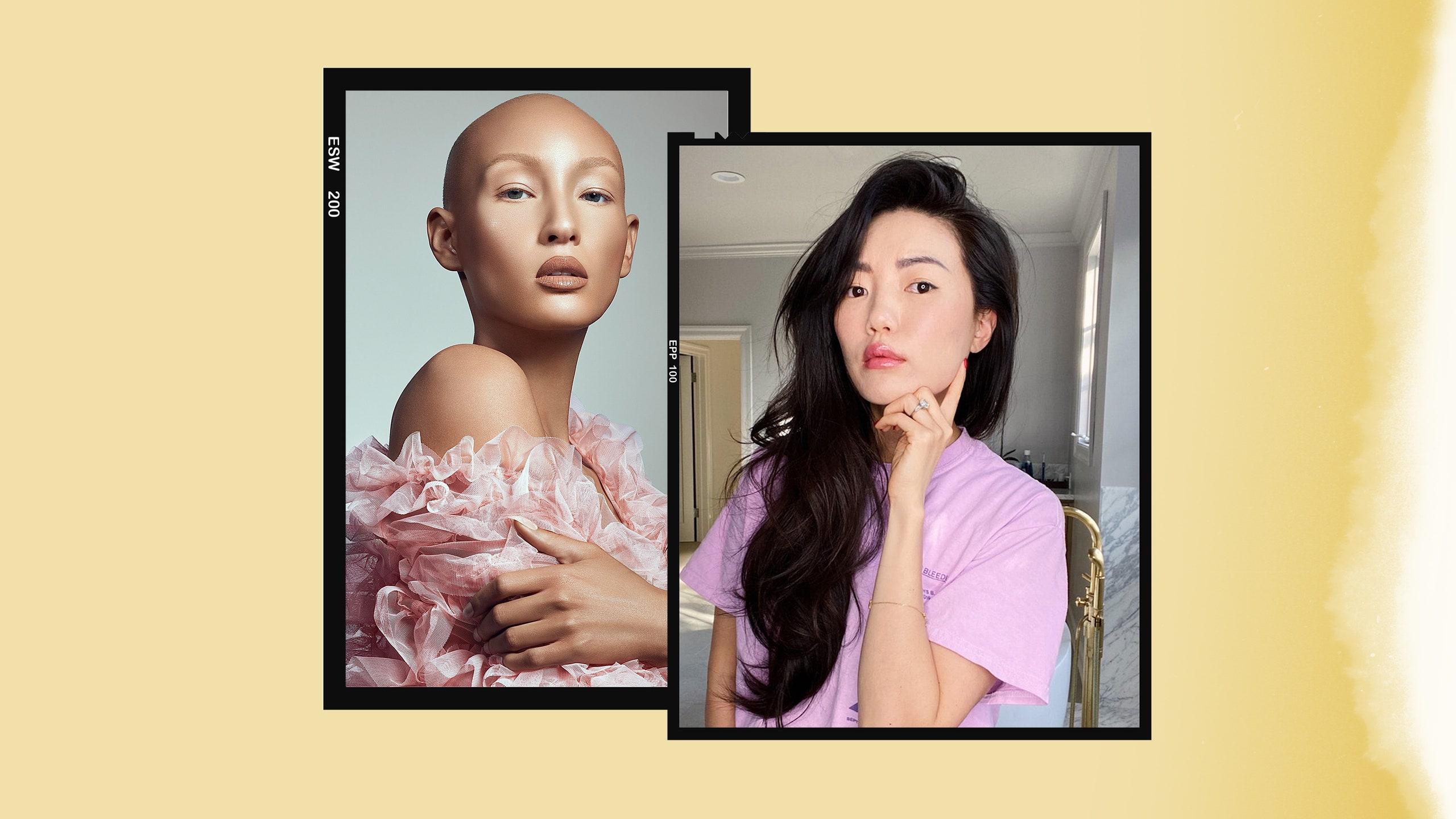 7 Stories of Early-Onset Hair Loss in Women Under 30 | Allure